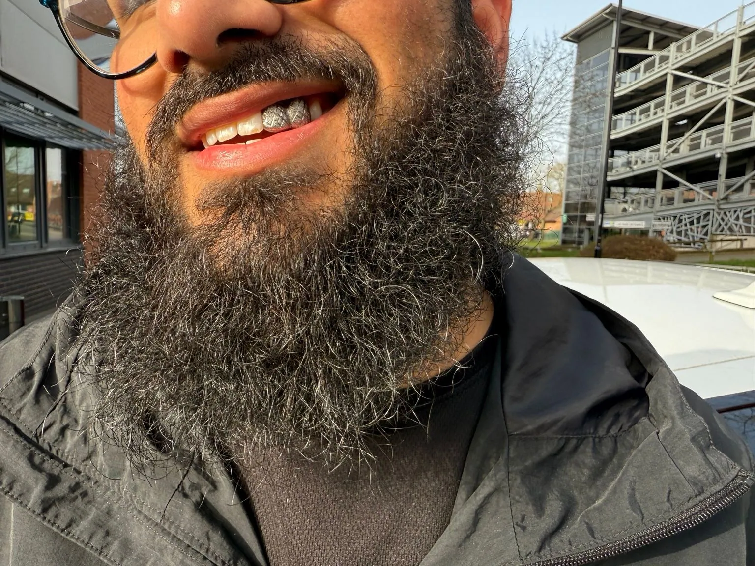 A bearded Matrix client in a selfie showing a patterned silver grillz set