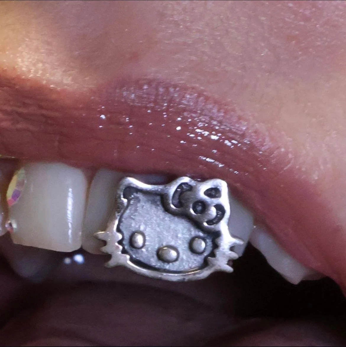 A custom silver tooth cap cast as a cartoon character face