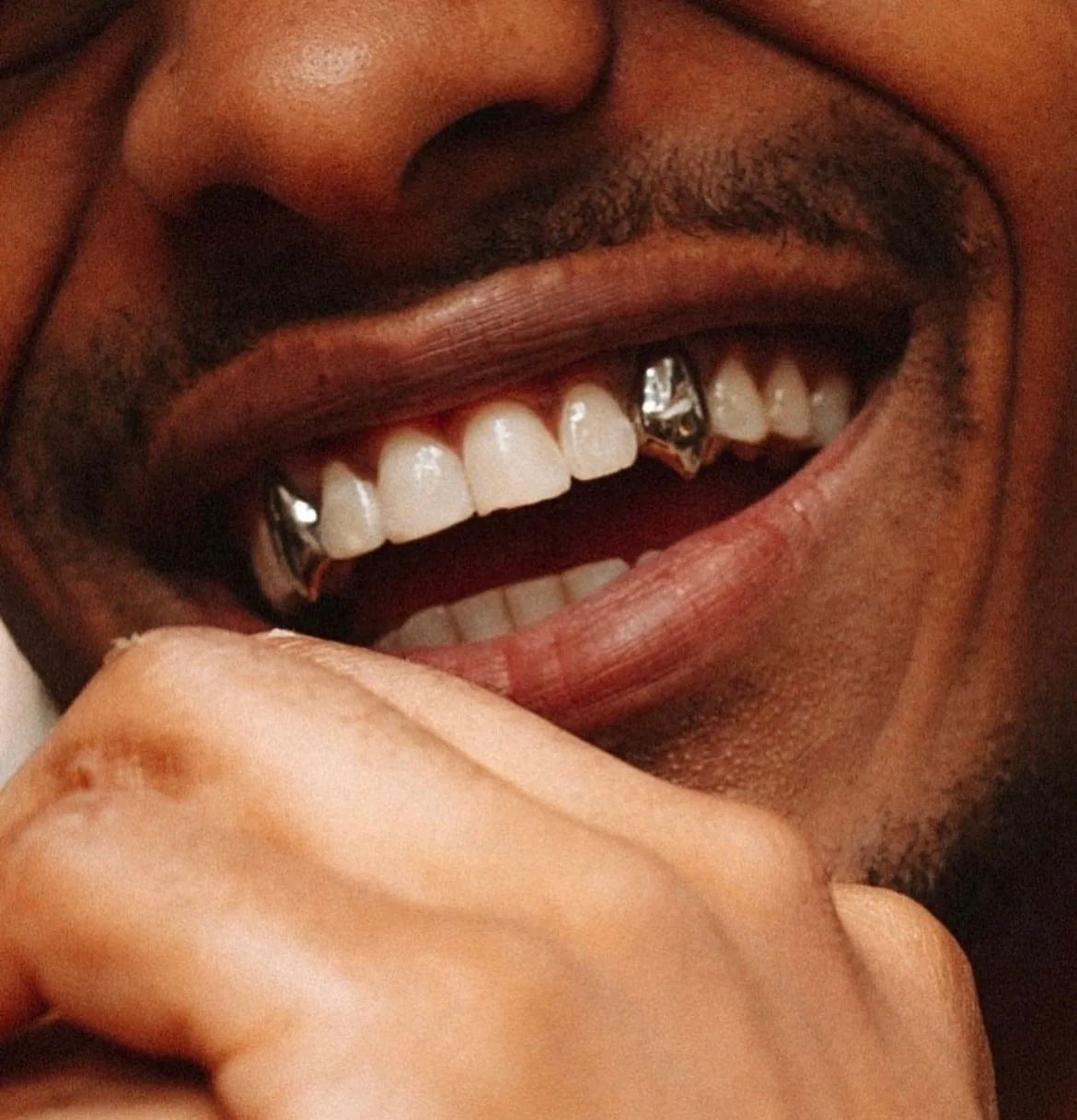 Custom grillz caps on both canine teeth in a wide smile