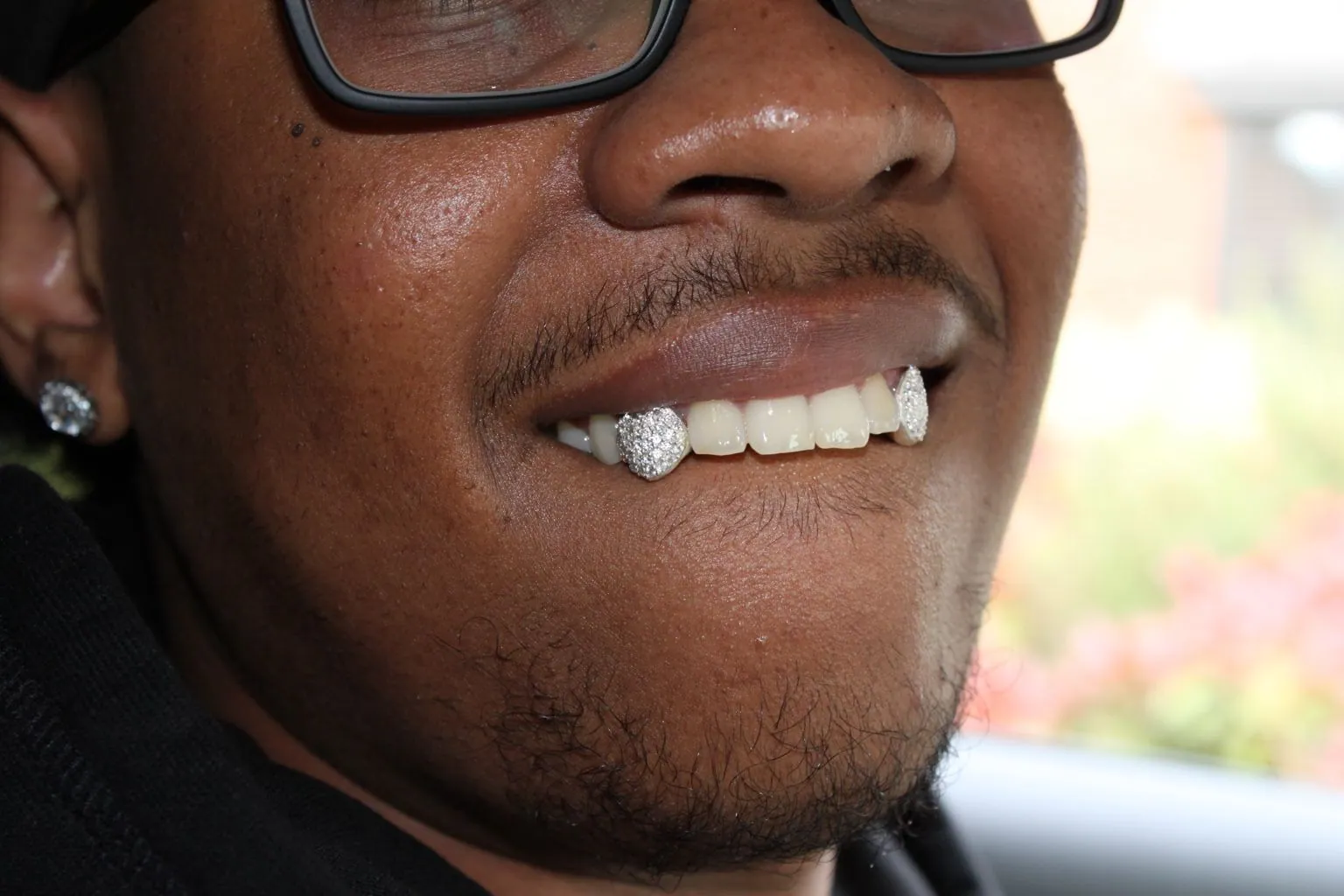 Close-up of a smile with diamond-set grillz on the canine teeth