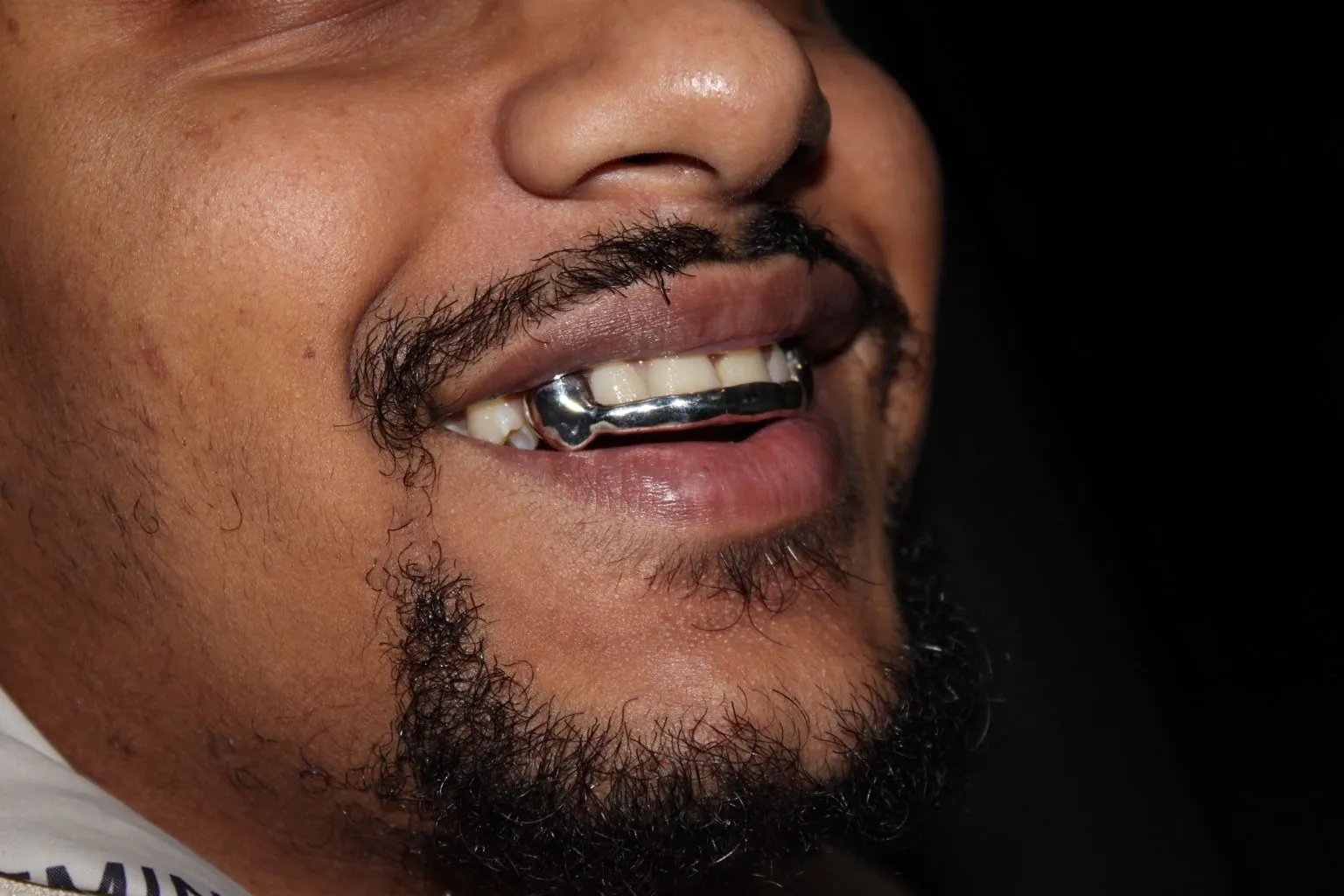 Close-up of a silver grillz cap on a side tooth